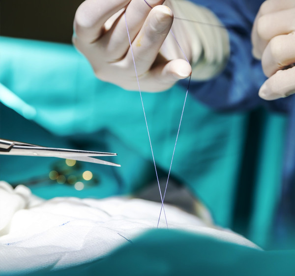 How Chitosan Advances Wound Care: